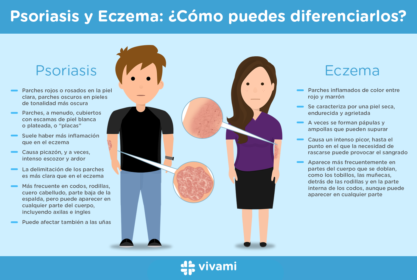 Psoriasis y Eczema